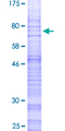 CALCRL / CGRP Receptor Protein - 12.5% SDS-PAGE of human CALCRL stained with Coomassie Blue