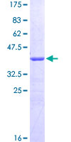 CALCRL / CGRP Receptor Protein - 12.5% SDS-PAGE Stained with Coomassie Blue.