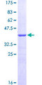 CALCRL / CGRP Receptor Protein - 12.5% SDS-PAGE Stained with Coomassie Blue.