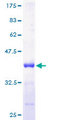 Calgizzarin / S100A11 Protein - 12.5% SDS-PAGE of human S100A11 stained with Coomassie Blue