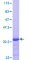 Calgizzarin / S100A11 Protein - 12.5% SDS-PAGE Stained with Coomassie Blue.
