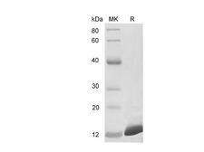 Calgizzarin / S100A11 Protein - Recombinant Human S100A11 protein (His Tag)