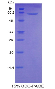 CALM1 / Calmodulin Protein - Recombinant Calmodulin 1 By SDS-PAGE