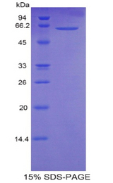CALM1 / Calmodulin Protein - Recombinant Calmodulin 1 By SDS-PAGE