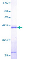 CALM2 / Calmodulin 2 Protein - 12.5% SDS-PAGE of human CALM2 stained with Coomassie Blue