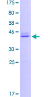 CALM2 / Calmodulin 2 Protein - 12.5% SDS-PAGE of human CALM2 stained with Coomassie Blue