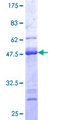 CALM3 / Calmodulin 3 Protein - 12.5% SDS-PAGE of human CALM3 stained with Coomassie Blue