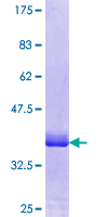 CALM3 / Calmodulin 3 Protein - 12.5% SDS-PAGE Stained with Coomassie Blue.