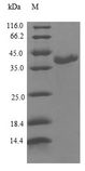 CALML3 Protein - (Tris-Glycine gel) Discontinuous SDS-PAGE (reduced) with 5% enrichment gel and 15% separation gel.