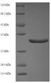CALML5 Protein - (Tris-Glycine gel) Discontinuous SDS-PAGE (reduced) with 5% enrichment gel and 15% separation gel.