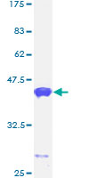 CALML5 Protein - 12.5% SDS-PAGE of human CALML5 stained with Coomassie Blue