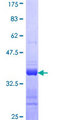 CALML5 Protein - 12.5% SDS-PAGE Stained with Coomassie Blue.