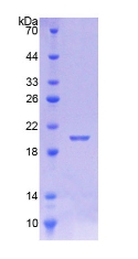 CALML5 Protein - Recombinant  Calmodulin Like Protein 5 By SDS-PAGE