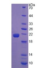 CALR / Calreticulin Protein - Recombinant Calreticulin By SDS-PAGE