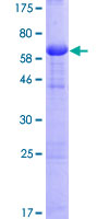 CALU / Calumenin Protein - 12.5% SDS-PAGE of human CALU stained with Coomassie Blue
