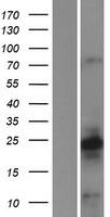 CALY Protein - Western validation with an anti-DDK antibody * L: Control HEK293 lysate R: Over-expression lysate