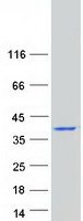 CALY Protein - Purified recombinant protein CALY was analyzed by SDS-PAGE gel and Coomassie Blue Staining