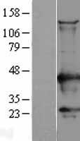CAMK1 / CAMKI Protein - Western validation with an anti-DDK antibody * L: Control HEK293 lysate R: Over-expression lysate