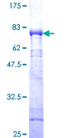 CAMK1 / CAMKI Protein - 12.5% SDS-PAGE of human CAMK1 stained with Coomassie Blue
