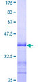 CAMK1 / CAMKI Protein - 12.5% SDS-PAGE Stained with Coomassie Blue.