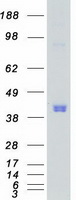 CAMK1 / CAMKI Protein - Purified recombinant protein CAMK1 was analyzed by SDS-PAGE gel and Coomassie Blue Staining