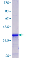 CAMK1D Protein - 12.5% SDS-PAGE Stained with Coomassie Blue