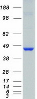 CAMK1D Protein - Purified recombinant protein CAMK1D was analyzed by SDS-PAGE gel and Coomassie Blue Staining