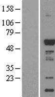 CAMK1G / CaMKI gamma Protein - Western validation with an anti-DDK antibody * L: Control HEK293 lysate R: Over-expression lysate