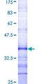 CAMK1G / CaMKI gamma Protein - 12.5% SDS-PAGE Stained with Coomassie Blue.
