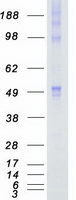 CAMK1G / CaMKI gamma Protein - Purified recombinant protein CAMK1G was analyzed by SDS-PAGE gel and Coomassie Blue Staining