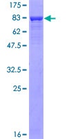 CAMK2A / CaMKII Alpha Protein - 12.5% SDS-PAGE of human CAMK2A stained with Coomassie Blue