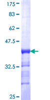 CAMK2A / CaMKII Alpha Protein - 12.5% SDS-PAGE Stained with Coomassie Blue.