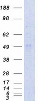 CAMK2A / CaMKII Alpha Protein - Purified recombinant protein CAMK2A was analyzed by SDS-PAGE gel and Coomassie Blue Staining