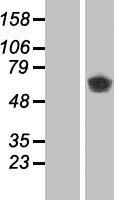 CAMK2B / CaMKII Beta Protein - Western validation with an anti-DDK antibody * L: Control HEK293 lysate R: Over-expression lysate