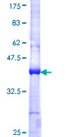 CAMK2B / CaMKII Beta Protein - 12.5% SDS-PAGE Stained with Coomassie Blue.