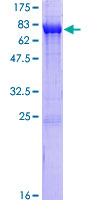 CAMK2D / CaMKII Delta Protein - 12.5% SDS-PAGE of human CAMK2D stained with Coomassie Blue