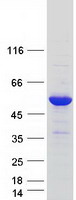 CAMK2D / CaMKII Delta Protein - Purified recombinant protein CAMK2D was analyzed by SDS-PAGE gel and Coomassie Blue Staining
