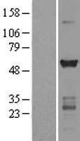 CAMK2G / CaMK II Gamma Protein - Western validation with an anti-DDK antibody * L: Control HEK293 lysate R: Over-expression lysate