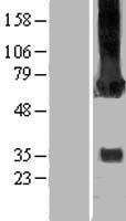 CAMK2G / CaMK II Gamma Protein - Western validation with an anti-DDK antibody * L: Control HEK293 lysate R: Over-expression lysate