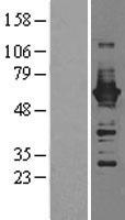 CAMK4 / CaMK IV Protein - Western validation with an anti-DDK antibody * L: Control HEK293 lysate R: Over-expression lysate