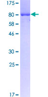 CAMK4 / CaMK IV Protein - 12.5% SDS-PAGE of human CAMK4 stained with Coomassie Blue