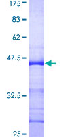 CAMK4 / CaMK IV Protein - 12.5% SDS-PAGE Stained with Coomassie Blue.