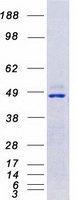 CAMK4 / CaMK IV Protein - Purified recombinant protein CAMK4 was analyzed by SDS-PAGE gel and Coomassie Blue Staining