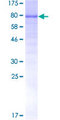 CAMKK1 Protein - 12.5% SDS-PAGE of human CAMKK1 stained with Coomassie Blue