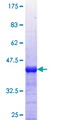 CAMKK1 Protein - 12.5% SDS-PAGE Stained with Coomassie Blue.