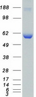 CAMKK1 Protein - Purified recombinant protein CAMKK1 was analyzed by SDS-PAGE gel and Coomassie Blue Staining
