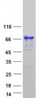 CAMKK1 Protein - Purified recombinant protein CAMKK1 was analyzed by SDS-PAGE gel and Coomassie Blue Staining