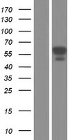 CAMKK2 Protein - Western validation with an anti-DDK antibody * L: Control HEK293 lysate R: Over-expression lysate