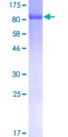 CAMKK2 Protein - 12.5% SDS-PAGE of human CAMKK2 stained with Coomassie Blue