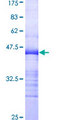CAMKK2 Protein - 12.5% SDS-PAGE Stained with Coomassie Blue.